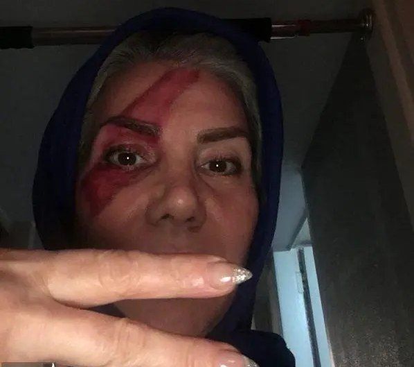 بلای وحشتناک مادر تتلو سر چهره اش بعد دستگیری پسرش+ تصویر