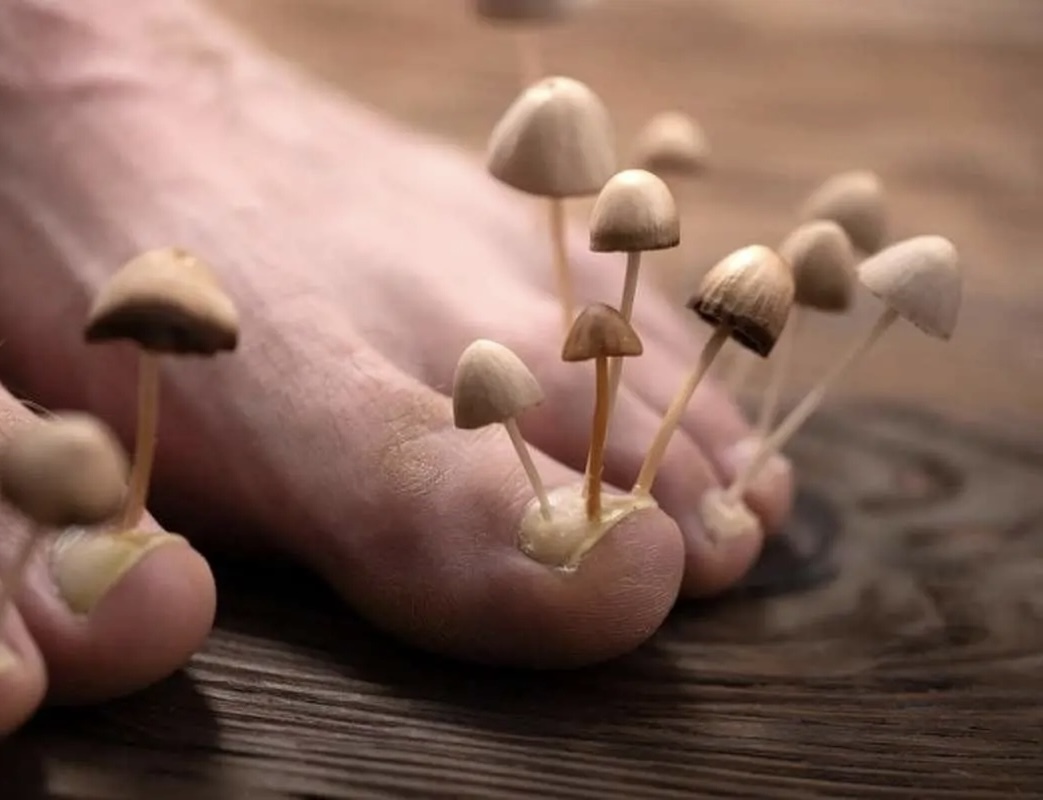 تخم‌مرغ گندیده، قاتل قارچ‌های ناخن!