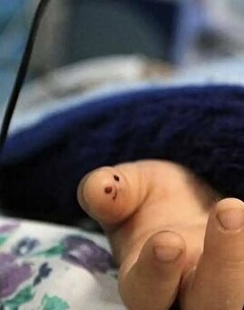 جزئیاتی از مرگ اسرارآمیز دختر سه و نیم‌ساله اهوازی بر اثر اصابت گلوله