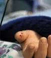 مرگ کودک ۳ ساله همدانی بر اثر روباه‌گزیدگی