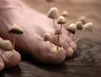 تخم‌مرغ گندیده، قاتل قارچ‌های ناخن!